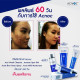 Acne Mild Moisturizer (Acnoc) - 40g.